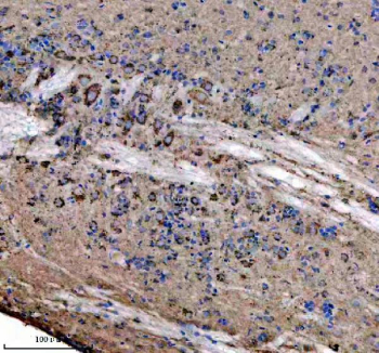 IHC staining of FFPE zebrafish brain tissue with Zebrafish Atp5b antibody. HIER: boil tissue sections in pH8 EDTA for 20 min and allow to cool before testing.