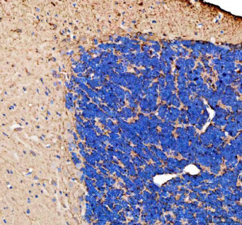 IHC staining of FFPE zebrafish brain tissue with Zebrafish Gap43 antibody. HIER: boil tissue sections in pH8 EDTA for 20 min and allow to cool before testing.