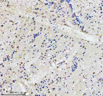 IHC staining of FFPE zebrafish brain tissue with Adrm1 antibody. HIER: boil tissue sections in pH8 EDTA for 20 min and allow to cool before testing.