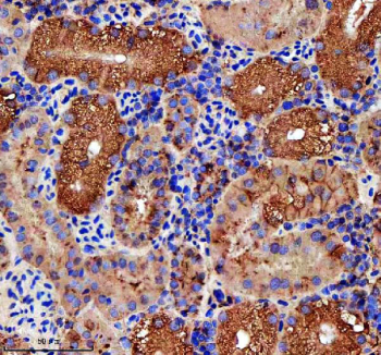 IHC staining of FFPE zebrafish kidney tissue with Zebrafish Rab3Gap1 antibody. HIER: boil tissue sections in pH8 EDTA for 20 min and allow to cool before testing.