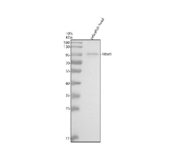 Western blot analysis of Rrm1 protein using Rrm1 antibody and zebrafish head tissue lysate. The predicted molecular weight of Rrm1 is ~90 kDa.
