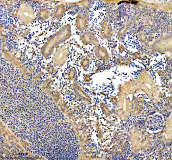 IHC staining of FFPE zebrafish kidney tissue with Zebrafish Eno1a antibody. HIER: boil tissue sections in pH8 EDTA for 20 min and allow to cool before testing.