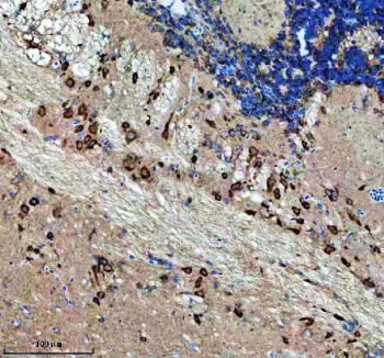 IHC staining of FFPE zebrafish brain tissue with Zebrafish Nova2 antibody. HIER: boil tissue sections in pH8 EDTA for 20 min and allow to cool before testing.