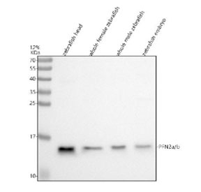 Western blot analysis of Pfn2a/b protein using Zebrafish Pfn2 antibody and 1) zebrafish head, 2) whole female zebrafish, 3) whole male zebrafish and 4) zebrafish embryo tissue lysate. Predicted molecular weight ~15 kDa.