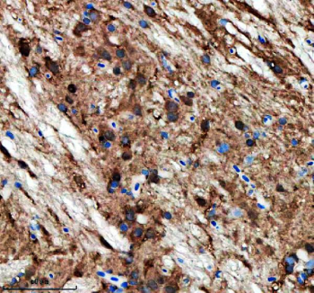 IHC staining of FFPE zebrafish brain tissue with Zebrafish Opa1 antibody. HIER: boil tissue sections in pH8 EDTA for 20 min and allow to cool before testing.