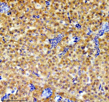 IHC staining of FFPE zebrafish liver tissue with Zebrafish Grpel1 antibody. HIER: boil tissue sections in pH8 EDTA for 20 min and allow to cool before testing.