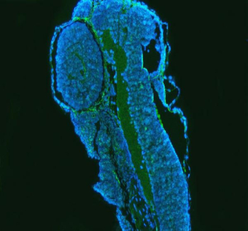 Immunofluorescent staining of FFPE zebrafish embryo tissue with Zebrafish Gbf1 antibody (green) and DAPI nuclear stain (blue). HIER: steam section in pH8 EDTA buffer for 20 min.