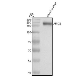 Western blot analysis of Arid2 protein using zebrafish Arid2 antibody and zebrafish head tissue lysate. The predicted molecular weight of ARID2 is ~197 kDa.