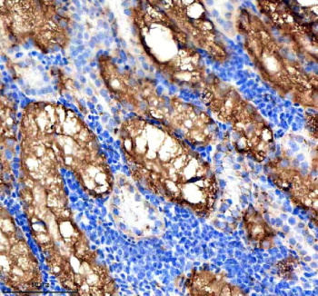 Immunohistochemical analysis of Vps53 protein using Vps53 antibody and paraffin-embedded zebrafish kidney tissue. HIER: boil tissue sections in pH8 EDTA for 20 min and allow to cool before testing.