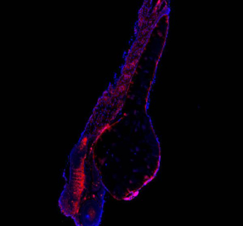 Immunofluorescent staining of FFPE zebrafish embryo tissue with Zebrafish Atp6v1a antibody (red) and DAPI nuclear stain (blue). HIER: steam section in pH8 EDTA buffer for 20 min.