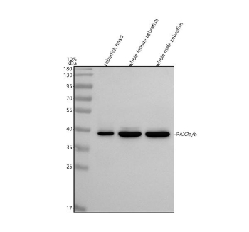 Western blot analysis of Pax2 protein using Zebrafish Pax2 antibody and 1) zebrafish head, 2) whole female zebrafish and 3) whole male zebrafish tissue lysate. Predicted molecular weight ~42 kDa (Pax2b) and ~44 kDa (Pax2a).