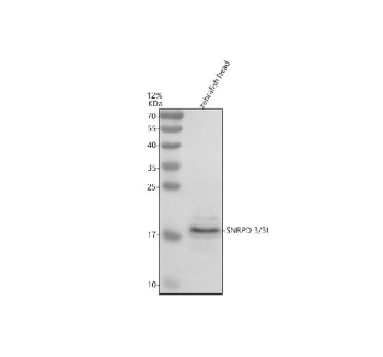 Western blot analysis of Snrpd3/3l protein using Zebrafish Snrpd3 antibody and zebrafish head tissue lysate. The predicted molecular weight of Snrpd3/3l is ~14 kDa.