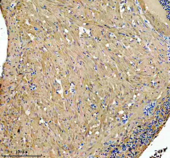 IHC staining of FFPE zebrafish brain tissue with Zebrafish Glud1 antibody, HRP secondary and DAB substrate. HIER: boil tissue sections in pH8 EDTA for 20 min and allow to cool before testing.