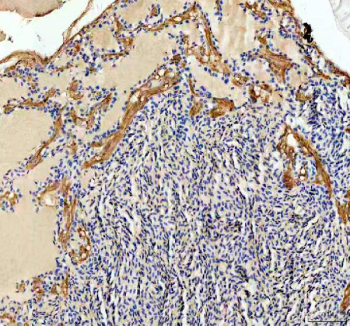 IHC staining of FFPE zebrafish brain tissue with Zebrafish Ckb antibody, HRP secondary and DAB substrate. HIER: boil tissue sections in pH8 EDTA for 20 min and allow to cool before testing.