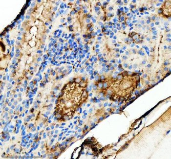 IHC staining of zebrafish Tgfb1 protein using Zebrafish Tgfb1 antibody, HRP-labeled secondary and DAB substrate. Tgfb1 was detected in a paraffin-embedded section of zebrafish kidney tissue. HIER: boil tissue sections in pH8 EDTA for 20 min and allow to cool before testing.