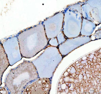 IHC staining of zebrafish Kita protein using Zebrafish Kita antibody, HRP-labeled secondary and DAB substrate. Kita was detected in a paraffin-embedded section of zebrafish ovary tissue. HIER: boil tissue sections in pH8 EDTA for 20 min and allow to cool before testing.