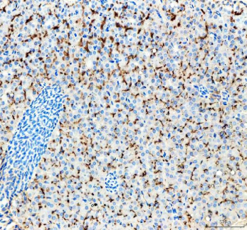 IHC staining of zebrafish Lhcgr protein using Zebrafish Lhcgr antibody, HRP-labeled secondary and DAB substrate. Lhcgr was detected in a paraffin-embedded section of zebrafish kidney tissue. HIER: boil tissue sections in pH8 EDTA for 20 min and allow to cool before testing.