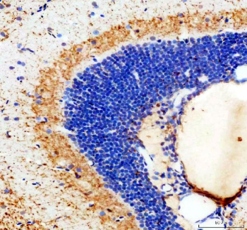 IHC staining of FFPE zebrafish brain tissue with Zebrafish Stat3 antibody, HRP-labeled secondary and DAB substrate. HIER: boil tissue sections in pH8 EDTA for 20 min and allow to cool before testing.