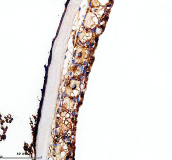 IHC staining of FFPE zebrafish skin tissue with Zebrafish Vangl2 antibody, HRP-labeled secondary and DAB substrate. HIER: boil tissue sections in pH8 EDTA for 20 min and allow to cool before testing.