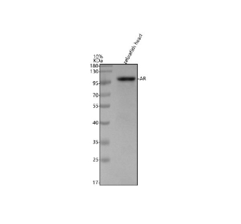 Western blot analysis of zebrafish Androgen receptor protein using Zebrafish Androgen receptor antibody and 1) zebrafish head tissue lysates. Predicted molecular weight ~96 kDa.