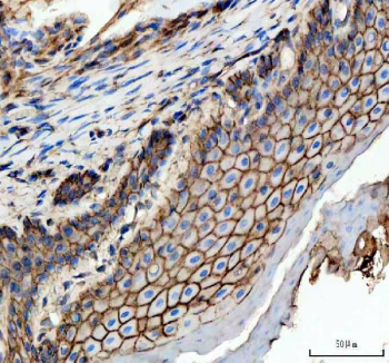 IHC staining of FFPE zebrafish esophageal epithelium tissue with Zebrafish E-cadherin antibody, HRP-labeled secondary and DAB substrate. HIER: boil tissue sections in pH8 EDTA for 20 min and allow to cool before testing.