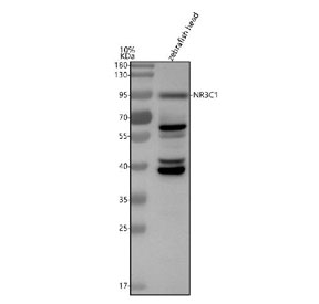 Western blot analysis of Glucocorticoid receptor protein using Zebrafish Glucocorticoid receptor antibody and zebrafish head tissue lysates.