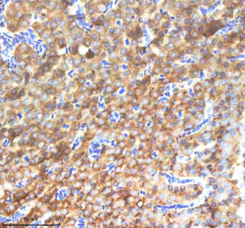 IHC staining of zebrafish Nanos3 protein using Zebrafish Nanos3 antibody, HRP-labeled secondary and DAB substrate. Nanos3 was detected in a paraffin-embedded section of zebrafish pancreas tissue. HIER: boil tissue sections in pH8 EDTA for 20 min and allow to cool before testing.