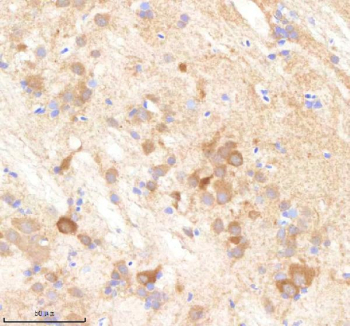 IHC staining of zebrafish Pabpc4 protein using Zebrafish Pabpc4 antibody, HRP-labeled secondary and DAB substrate. Pabpc4 was detected in a paraffin-embedded section of zebrafish brain tissue. HIER: boil tissue sections in pH8 EDTA for 20 min and allow to cool before testing.