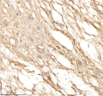 IHC staining of FFPE zebrafish spinal tissue with Psma5 antibody, HRP-labeled secondary and DAB substrate. HIER: boil tissue sections in pH8 EDTA for 20 min and allow to cool before testing.