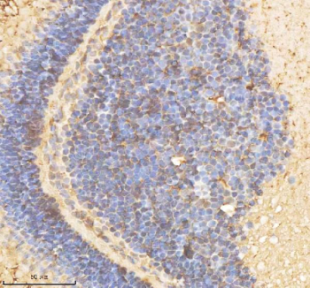 IHC staining of FFPE zebrafish eye tissue with Psmd2 antibody, HRP-labeled secondary and DAB substrate. HIER: boil tissue sections in pH8 EDTA for 20 min and allow to cool before testing.(Resolving gel) for 2 hours. Lane 1: zebrafish head tissue lysates,