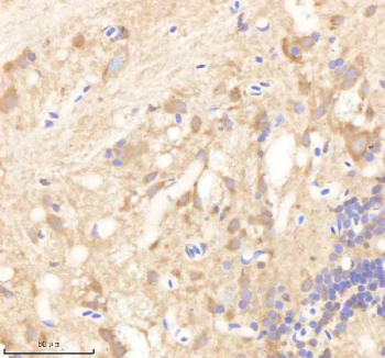 IHC staining of FFPE zebrafish brain tissue with Psmd6 antibody, HRP-labeled secondary and DAB substrate. HIER: boil tissue sections in pH8 EDTA for 20 min and allow to cool before testing.