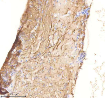 IHC staining of zebrafish Rab1aa/ab protein using Zebrafish Rab1a antibody, HRP-labeled secondary and DAB substrate. Rab1a was detected in a paraffin-embedded section of zebrafish spinal tissue. HIER: boil tissue sections in pH8 EDTA for 20 min and allow to cool before testing.