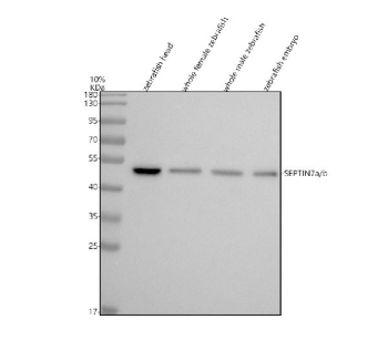 Western blot analysis of Septin7a/b protein using Zebrafish Septin7 antibody and 1) zebrafish head, 2) whole female zebrafish, 3) whole male zebrafish and 4) zebrafish embryo tissue lysate. Predicted molecular weight ~50 kDa.