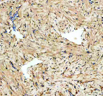 IHC staining of FFPE zebrafish heart tissue with Psmc3 antibody, HRP-labeled secondary and DAB substrate. HIER: boil tissue sections in pH8 EDTA for 20 min and allow to cool before testing.