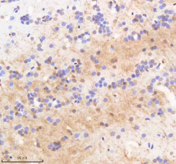 IHC staining of FFPE zebrafish brain tissue with Twist antibody, HRP-labeled secondary and DAB substrate. HIER: boil tissue sections in pH8 EDTA for 20 min and allow to cool before testing.