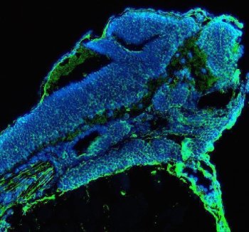 Zebrafish ACACA / Acetyl-CoA Carboxylase 1 Antibody Embryo IF. Immunofluorescent staining of FFPE zebrafish embryo tissue using Zebrafish ACACA Antibody demonstrates distinct green fluorescence throughout developing embryonic tissue compartments against a blue DAPI nuclear counterstain background. The staining pattern is consistent with expression of Acetyl-CoA Carboxylase 1 (ACACA), also known as ACC1, a rate-limiting enzyme in de novo fatty acid biosynthesis that catalyzes the conversion of acetyl-CoA to malonyl-CoA. Signal is observed within embryonic structures undergoing active growth and metabolic development, reflecting the essential role of ACACA in lipid synthesis, membrane biogenesis, and cellular energy homeostasis during vertebrate embryogenesis. Heat mediated antigen retrieval was performed in EDTA buffer. Primary antibody was incubated overnight at 4oC followed by detection using a DyLight 488-conjugated goat anti-rabbit secondary antibody. Nuclei were counterstained with DAPI.