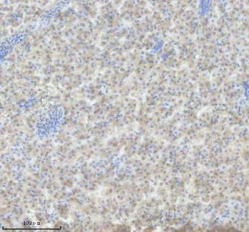 Zebrafish IL-4 Antibody IHC. Immunohistochemistry analysis of IL4 using anti-IL4 antibody. IL4 was detected in a paraffin-embedded section of zebrafish liver tissue. Heat mediated antigen retrieval was performed in EDTA buffer. The tissue section was blocked with 10% goat serum. The tissue section was then incubated with 2 ug/ml rabbit anti-IL4 Antibody overnight at 4oC. Peroxidase Conjugated Goat Anti-rabbit IgG was used as secondary antibody and incubated for 30 minutes at 37oC. The tissue section was developed using DAB as the chromogen.