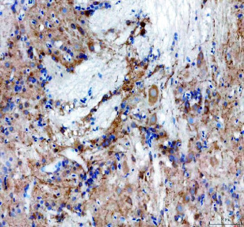 Zebrafish SLC6A4 / SLC6A4A Antibody Brain IHC. Immunohistochemistry staining of FFPE zebrafish brain tissue using Zebrafish SLC6A4 Antibody demonstrates distinct cytoplasmic HRP-DAB brown staining within scattered neuronal cell populations and neuropil-associated structures. The staining pattern is consistent with expression of Solute Carrier Family 6 Member 4A (SLC6A4A), a serotonin transporter that regulates serotonergic neurotransmission through reuptake of extracellular serotonin at neuronal synapses. Signal is observed throughout neural tissue compartments associated with neuronal communication and serotonin-dependent signaling pathways. Heat mediated antigen retrieval was performed in EDTA buffer. Primary antibody was incubated overnight at 4Â°C followed by detection using a peroxidase-conjugated goat anti-rabbit secondary antibody and DAB chromogen.