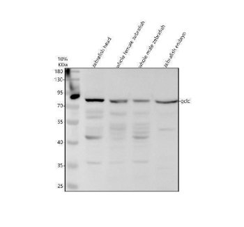 Zebrafish GCLC Antibody WB. Western blot analysis of GCLC using Zebrafish GCLC Antibody / Glutamate-Cysteine Ligase Antibody demonstrates a prominent immunoreactive band at approximately 80 kDa in zebrafish head, whole female, whole male, and embryo tissue lysates. The observed molecular weight is slightly higher than the predicted size of approximately 73 kDa, which may reflect post-translational modification or differences in electrophoretic migration. GCLC is the catalytic subunit of glutamate-cysteine ligase, the rate-limiting enzyme in glutathione biosynthesis and a central regulator of cellular antioxidant defense pathways. Consistent detection across developmental and adult tissue samples supports broad expression of GCLC and confirms recognition of the target protein. The observed immunoreactivity demonstrates the utility of this antibody for studies of glutathione metabolism, oxidative stress responses, redox regulation, detoxification pathways, developmental biology, and cellular antioxidant defense mechanisms in zebrafish models.