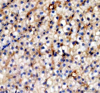Zebrafish Cytokeratin 8 Antibody IHC. Immunohistochemistry analysis of KRT8 using anti-KRT8 antibody. KRT8 was detected in a paraffin-embedded section of zebrafish eye tissue. Heat mediated antigen retrieval was performed in EDTA buffer. The tissue section was blocked with 10% goat serum. The tissue section was then incubated with 2 ug/ml rabbit anti-KRT8 Antibody overnight at 4oC. Peroxidase Conjugated Goat Anti-rabbit IgG was used as secondary antibody and incubated for 30 minutes at 37oC. The tissue section was developed using DAB as the chromogen.