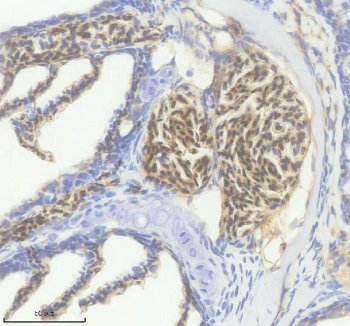 Zebrafish HBAE3 Antibody Erythrocyte IHC. Immunohistochemical staining of paraffin-embedded zebrafish erythrocytes using Zebrafish HBAE3 Antibody / Hemoglobin Alpha Embryonic 3 Antibody demonstrates strong HRP-DAB brown staining within clustered erythroid cells. The staining pattern is consistent with expression of HBAE3, an embryonic alpha-globin protein that contributes to hemoglobin complex formation and oxygen transport during early vertebrate development. HBAE3 is associated with hematopoietic tissues, developing blood cell populations, and the embryonic vasculature, where it supports oxygen delivery to rapidly growing tissues. The observed erythrocyte-associated staining is consistent with the established role of HBAE3 in embryonic hematopoiesis, erythroid differentiation, and developmental oxygen transport. Heat-mediated antigen retrieval was performed in EDTA buffer, followed by overnight incubation with 2 Âµg/ml primary antibody and HRP-DAB visualization.