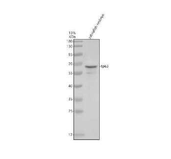 Zebrafish TP63 Antibody Western Blot. Western blot analysis of zebrafish embryo tissue lysate using Zebrafish TP63 Antibody / p63 Antibody demonstrates a distinct immunoreactive band at approximately 63 kDa, consistent with the predicted molecular weight of TP63 (tumor protein p63), a p53-family transcription factor involved in epithelial development, epidermal differentiation, stem cell maintenance, and tissue morphogenesis. TP63 is widely used as a marker of basal epithelial cell populations and developing ectoderm-derived tissues in zebrafish developmental biology studies. Thirty micrograms of zebrafish embryo lysate were resolved under reducing conditions on a 10% SDS-PAGE gel and transferred to nitrocellulose prior to immunodetection. The observed band supports expression of TP63 in developing zebrafish tissues and demonstrates suitability of this antibody for western blot analysis. Expected molecular weight: ~63 kDa.