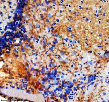 Zebrafish GNRHR4 Antibody Brain IHC. Immunohistochemistry staining of paraffin-embedded zebrafish brain tissue using GNRHR4 antibody demonstrates widespread cytoplasmic and membranous staining within neural cell populations, consistent with expression of Gonadotropin-Releasing Hormone Receptor 4 (GNRHR4). GNRHR4 is a G protein-coupled receptor that mediates neuroendocrine signaling pathways involved in hormonal communication, reproductive regulation, and endocrine system function. The observed staining pattern within brain tissue is consistent with the established role of GnRH receptor family members in coordinating neuronal and endocrine signaling networks that regulate physiologic homeostasis and vertebrate development. Heat-mediated antigen retrieval was performed in EDTA buffer. Tissue sections were stained with 2 ug/ml primary antibody and visualized using DAB chromogen.
