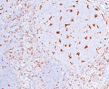 CD68 antibody C68/684 immunohistochemistry tonsil