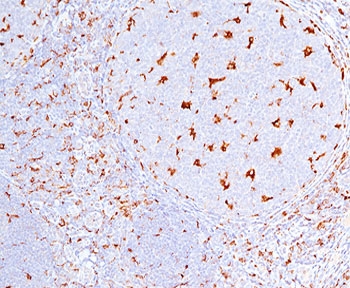 CD68 antibody C68/684 immunohistochemistry tonsil