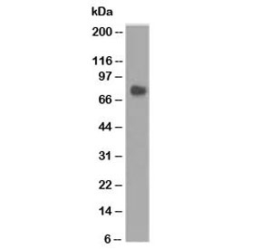 Western blot testing of human stomach lysate using CEA antibody (COL-1).