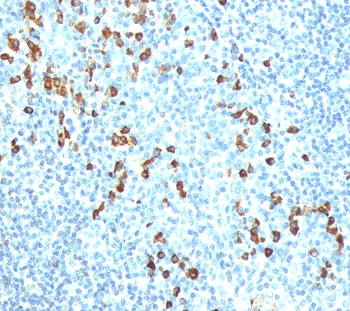 IHC testing of human tonsil stained with anti-IgM antibody (IM260).