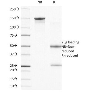 SDS-PAGE Analysis of Purified, BSA-Free Integrin Beta 4 Antibody (clone UM-A9). Confirmation of Integrity and Purity of the Antibody.