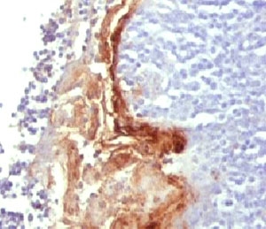 IHC analysis of FFPE human tonsil tissue and Involucrin antibody (clone SY5).