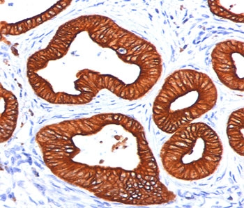 IHC staining of FFPE human skin tissue stained with Cytokeratin 18 antibody (clone DC10).